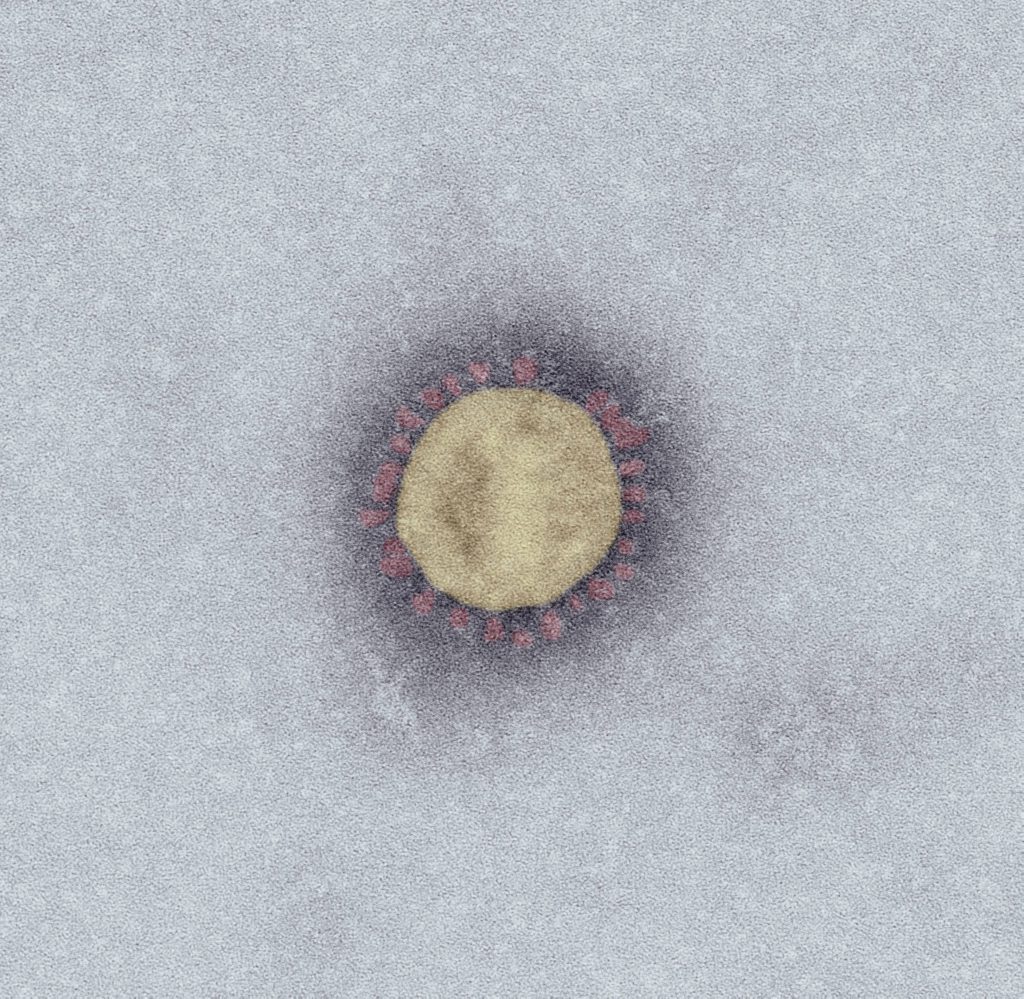 Das Corona-Virus unter dem Elektronenmikroskop